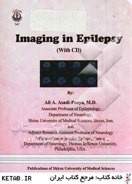 Imaging in epilepsy (with CD)