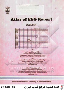 Atlas of Ictal EEG report (with CD)