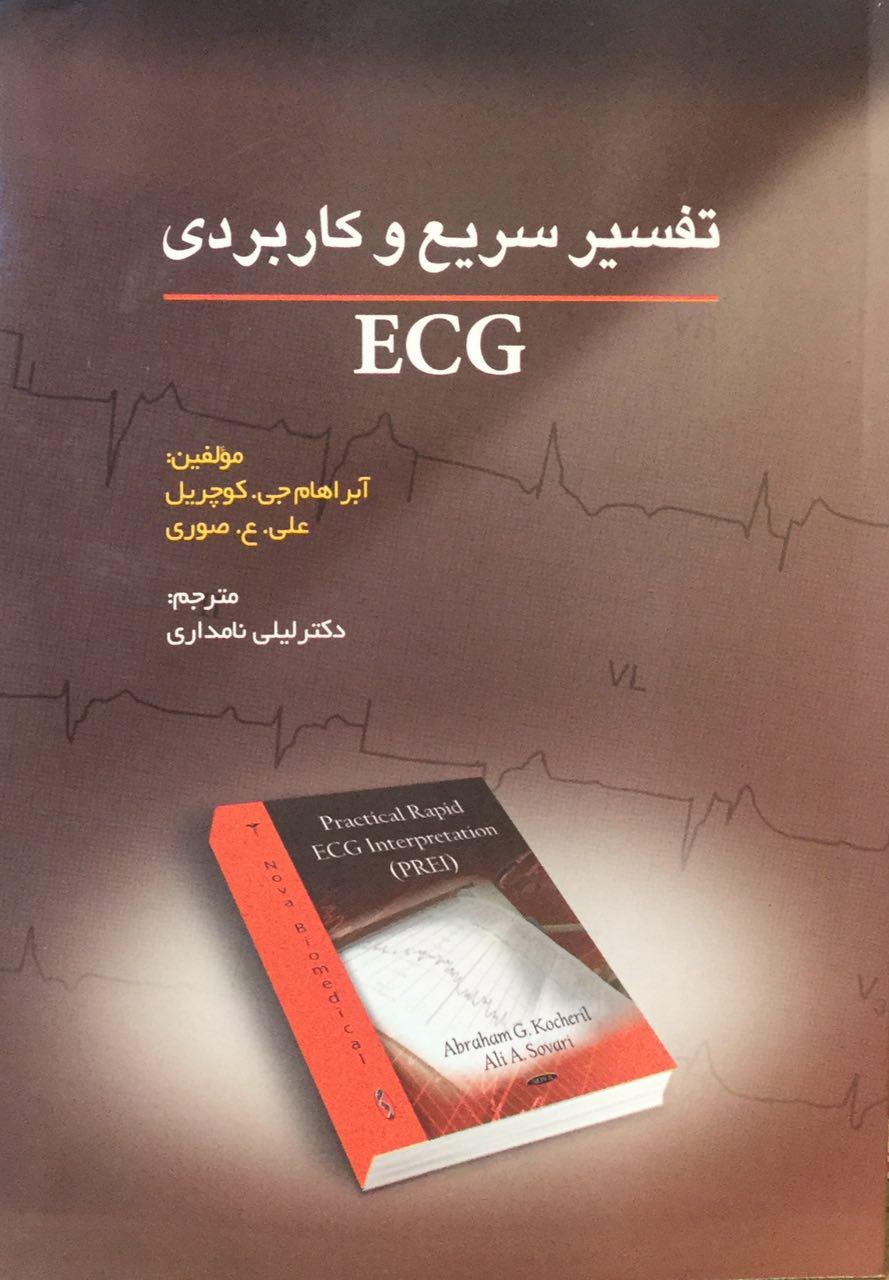 تفسير سريع و كاربردي ECG