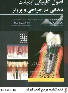 اصول كلينيكي ايمپلنت دنداني در جراحي و پروتز